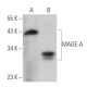 MAGE-A Antibody (A-1) - Western Blotting - Image 379345