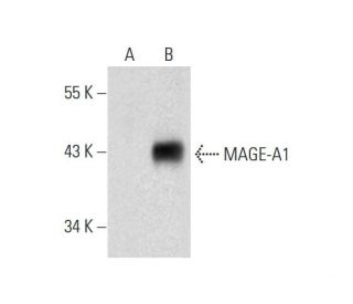 MAGE-A1 Antibody (MA454) - Western Blotting - Image 131640 