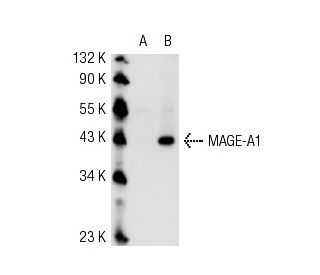 MAGE-A1 Antibody (3F256) - Western Blotting - Image 54430 