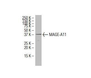 MAGE-A11 Antibody (YN-2) - Western Blotting - Image 34581