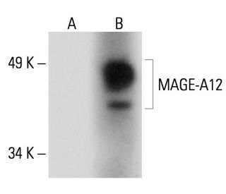 MAGE Antibody (F-4) - Western Blotting - Image 288575 