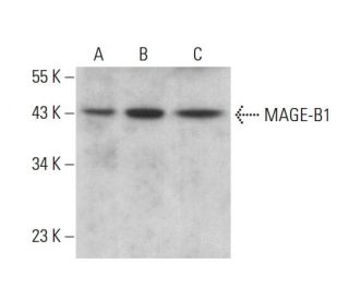 MAGE-B1 Antibody (B-9) - Western Blotting - Image 376359 