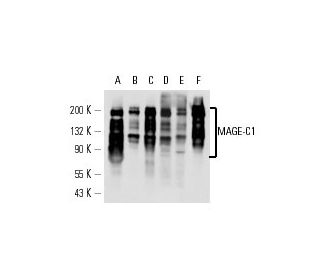 MAGE-C1 Antibody (CT7-33) - Western Blotting - Image 14756 