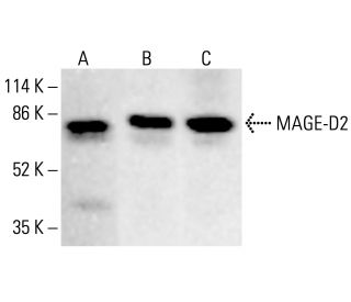MAGE-D2 Antibody (FW.6) - Western Blotting - Image 412790 