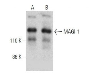 MAGI-1 Antibody (SS-5) - Western Blotting - Image 368559 