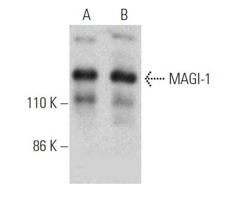 Magi 1 Antibody Ss 5 Scbt Santa Cruz Biotechnology