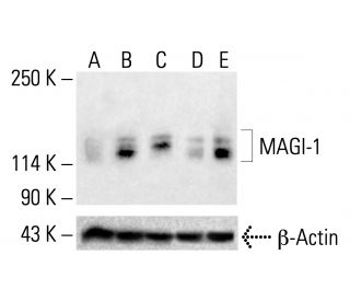 MAGI-1 Antibody (SS-5) - Western Blotting - Image 412737The Double Nickase Plasmid features a U6 promoter for sgRNA expression, a 20 nt targeting sequence, and a gRNA scaffold to guide Cas9n. It includes a CBh promoter for Cas9n (D10A) and puromycin resistance, GFP for transfection verification, and nuclear localization signals (NLS). The 2A peptide allows co-expression of Cas9n and Puro from a single promoter, enabling precise genome editing with reduced off-target effects.