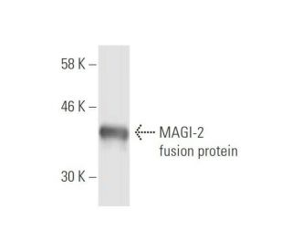 western blotting image from recommended MAGI-2 (6F5) monoclonal antibody replacement. Image 349011