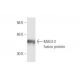 western blotting image from recommended MAGI-2 (6F5) monoclonal antibody replacement. Image 349011