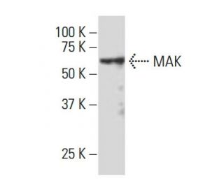 MAK Antibody (JK-10) - Western Blotting - Image 33805 
