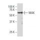MAK Antibody (JK-10) - Western Blotting - Image 33805 