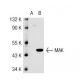 MAK Antibody (JK-10) - Western Blotting - Image 42682 