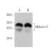 Makorin-2 Antibody (C-5) - Western Blotting - Image 372019 