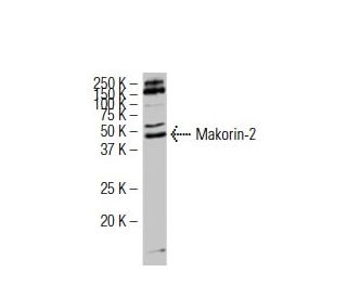 Makorin-2 Antibody (FG-9) - Western Blotting - Image 34480 
