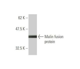 Malin Antibody (3G6) - Western Blotting - Image 350367