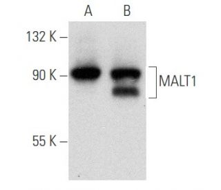 MALT1 Antibody (B-12) - Western Blotting - Image 354702 