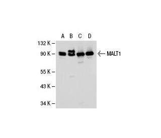 MALT1 Antibody (clone 50) - Western Blotting - Image 21543 