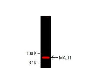 MALT1 Antibody (D-1) - Western Blotting - Image 381619