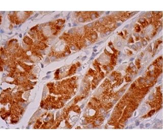 MAN2A1 Antibody (53FC3) - Immunohistochemistry - Image 293423