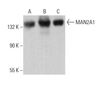 MAN2A1 Antibody (D-5) - Western Blotting - Image 375394 