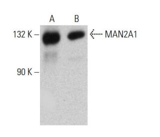 MAN2A1 Antibody (F-10) - Western Blotting - Image 384469 