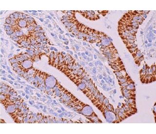 mao-a-antibody-g-10-