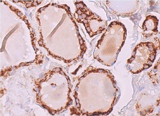 MAO-A Antibody (G-10) | SCBT - Santa Cruz Biotechnology
