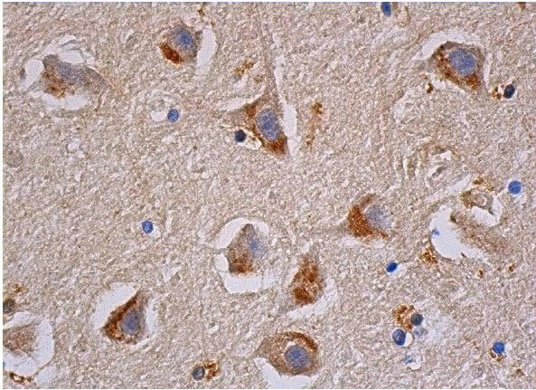 アナトミー 2 SP-B抗体(F-2) | SCBT - Santa Cruz Biotechnology