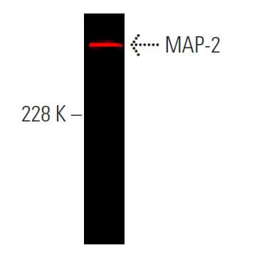 maページ MAP2 Monoclonal Antibody (M13) (13-1500)