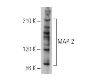 MAP-2 Antibody (AP20) | SCBT - Santa Cruz Biotechnology
