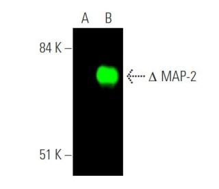 western blotting image from recommended MAP-2 (A-4) monoclonal antibody replacement. Image 374293