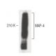 MAP-4 Antibody (18) - Western Blotting - Image 60356
