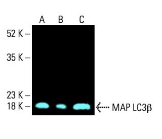 123456様 anti-lc3b-antibody-