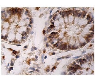 123456様 コンバース CONVERSE オールスター ボーダースター OX