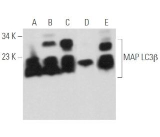 LC3B Antibody (G-9) - Western Blotting - Image 360468 