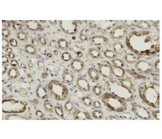 MAPKAPK-2 Antibody (35-I) - Immunohistochemistry - Image 36002 