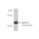 MARCH6 Antibody (1A5) - Western Blotting - Image 349021