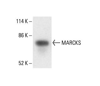 MARCKS Antibody (C-6) - Western Blotting - Image 411943