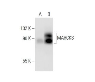 MARCKS (JK-8): sc-100777. Western blot analysis of MARCKS expression in...
