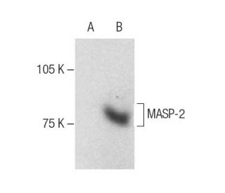 western blotting image from recommended MASP-2 (B-10) monoclonal antibody replacement. Image 286881