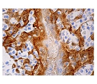 Maspin Antibody (E-10) - Immunohistochemistry - Image 158904 