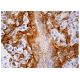 Maspin Antibody (E-10) - Immunohistochemistry - Image 158904 