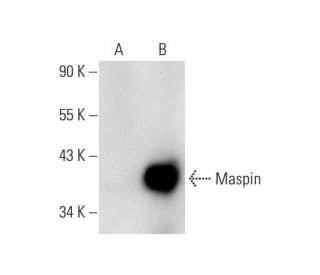 Maspin Antibody (E-10) - Western Blotting - Image 70187Each CRISPR/Cas9 Knockout (KO) Plasmid product consists of a pool of 3 plasmids designed to ensure identification and cleavage of a specific gene for maximum knockout efficiency. Each plasmid encodes a unique 20 nt sequence derived from the GeCKO (v2) library. 