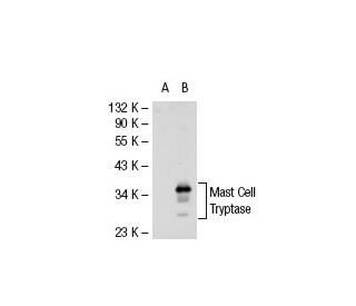Mast Cell Tryptase Antibody (AA1) - Western Blotting - Image 31805 