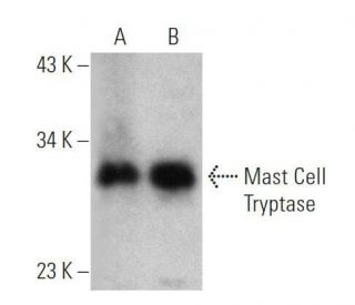 western blotting image from recommended Mast Cell Tryptase (G3) monoclonal antibody replacement. Image 355306