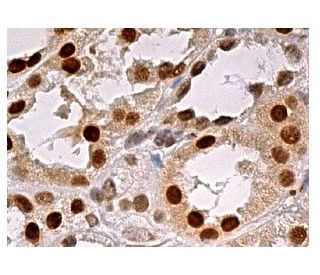 MAT I&alpha;/II&alpha;(A-10) - Immunohistochemistry - Image 159037 