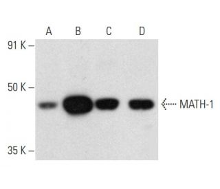 MATH 1 Antibody 18A6 SCBT Santa Cruz Biotechnology