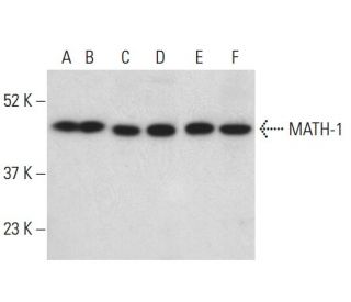 MATH-1 Antibody (18A6) - Western Blotting - Image 398490