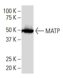 MATP Antibody (7K-2) | SCBT - Santa Cruz Biotechnology