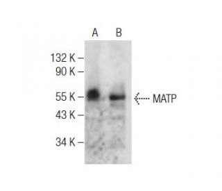 MATP Antibody (F-4) - Western Blotting - Image 284446 